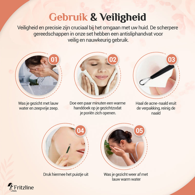 Fritzline Blackhead Remover - Mee Eter Verwijderaar - Acne Verwijderen Set - Comedonendrukker - Mee Eters Verwijderen